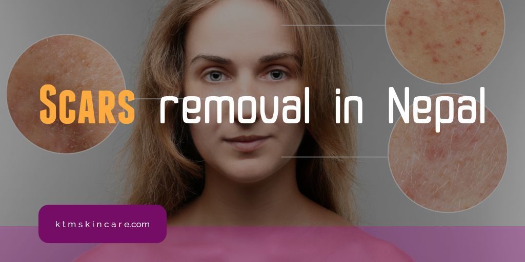 Scars Removal In Nepal